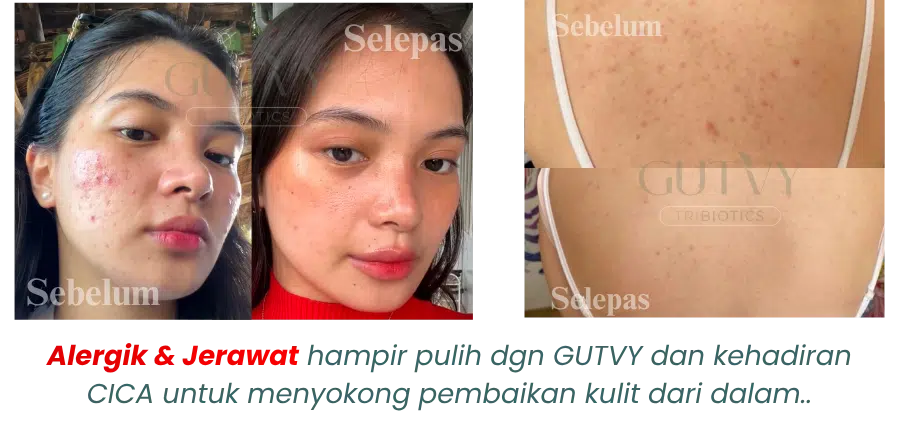 Belyn (13)